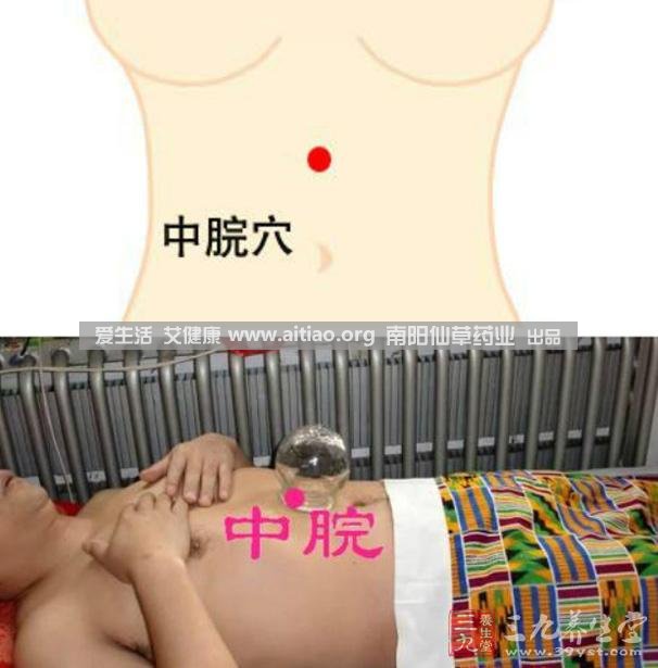 中脘穴位于腹部正中線，臍上4寸的位置上。每天艾灸10-15分鐘，能有效緩解胃部不適的癥狀，同時有助于祛濕。